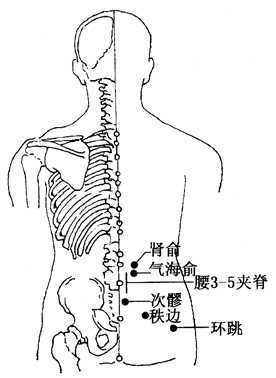 坐骨神經(jīng)痛的治療方法，哪種方式能最快緩解你的疼痛？，坐骨神經(jīng)痛快速緩解方法與治療方式探討