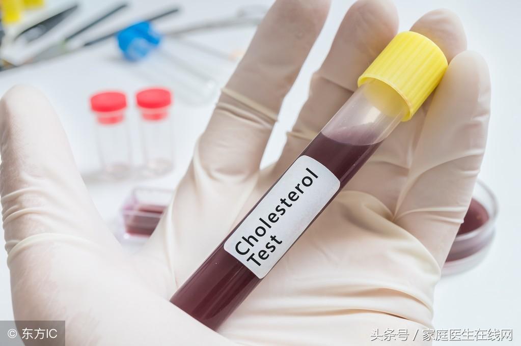 糖尿病的成因，深度解析其背后的原因，深度解析糖尿病成因，揭示背后原因真相
