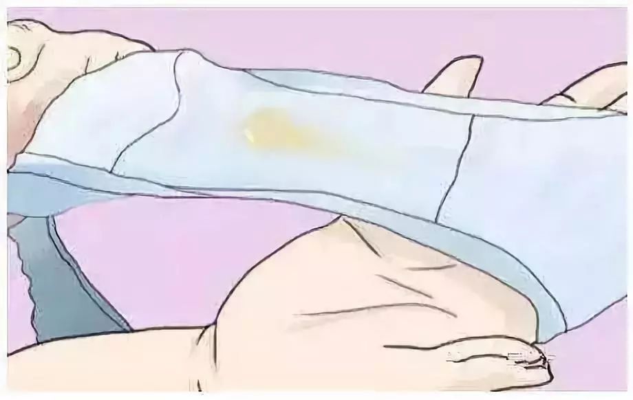 女性健康