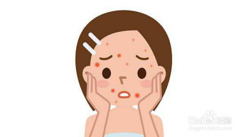 如何快速去除青春痘，方法與技巧詳解，快速去除青春痘方法與技巧詳解