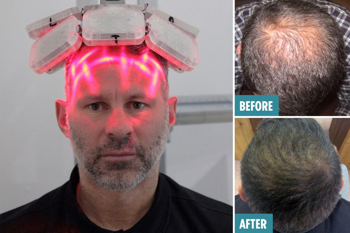 激光手術(shù)費(fèi)用詳解，多少錢一次？，激光手術(shù)費(fèi)用全面解析，手術(shù)費(fèi)用究竟是多少？