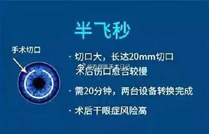 全飛秒和半飛秒哪個更好，深度解析兩種近視矯正技術(shù)的優(yōu)劣，全飛秒與半飛秒近視矯正技術(shù)對比，深度解析優(yōu)劣差異