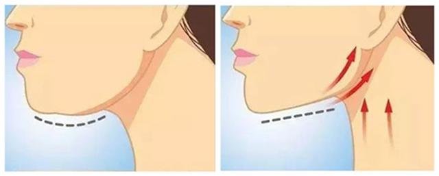 如何排出臉上的毒素——打造健康肌膚光彩，臉部排毒秘訣，打造健康肌膚光彩的秘訣