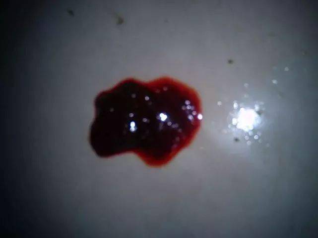 排便時(shí)出現(xiàn)撕裂感及出血，原因與應(yīng)對(duì)措施，排便疼痛撕裂感及出血，原因分析及應(yīng)對(duì)方法