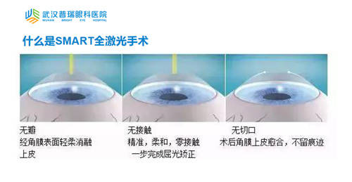 晶體植入近視手術的利與弊，全面解析與深度探討，晶體植入近視手術的利與弊，全面解析與深度探討深度探討及解析近視手術晶體植入利弊
